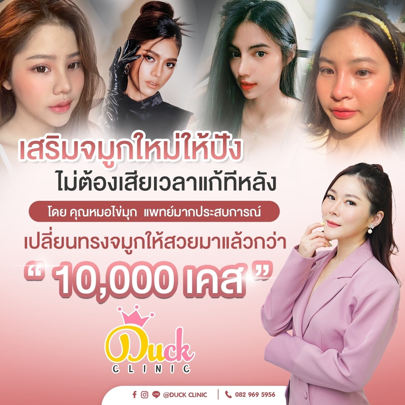 รวม 10 คลินิกเสริมจมูก ราคาไม่แพง ฝีมือดี จ่ายแค่หลักพัน - ออนฟอน | Onfond